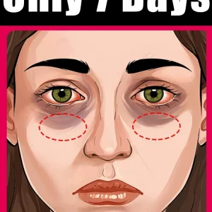Wrinkle-Removing Eye Cream Tool for Dark Circles & Eye Bags