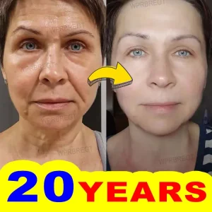 20 Years Younger Skin